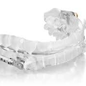 Herbst oral appliance